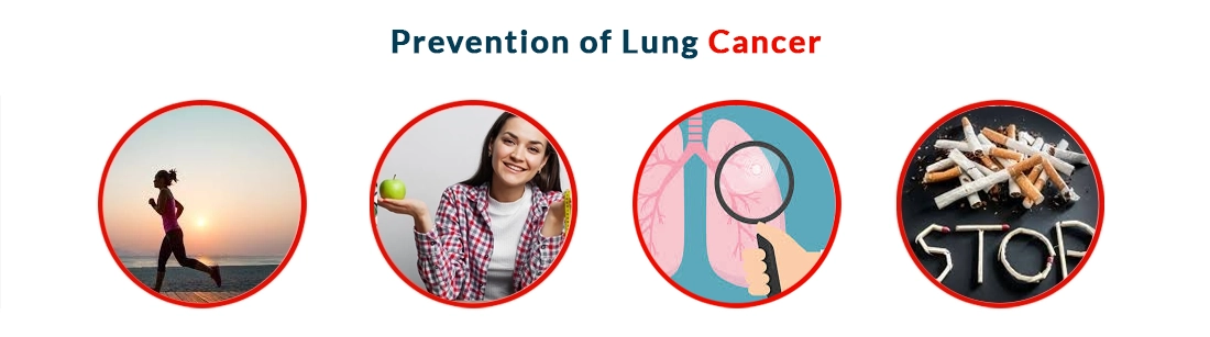 Prevention of Lung Cancer